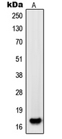 PDGF-AA Antibody - Western blot analysis of PDGFA expression in HL60 (A) whole cell lysates.