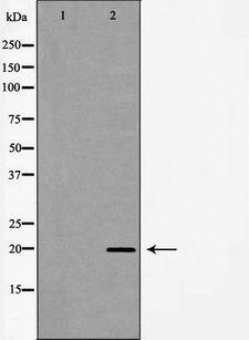 PDGF-AA Antibody - Western blot analysis of PDGFA expression in Jurkat cells. The lane on the left is treated with the antigen-specific peptide.