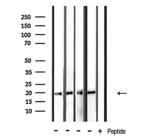 PDGF-AA Antibody - Western blot analysis of extracts of various samples using PDGFA antibody.