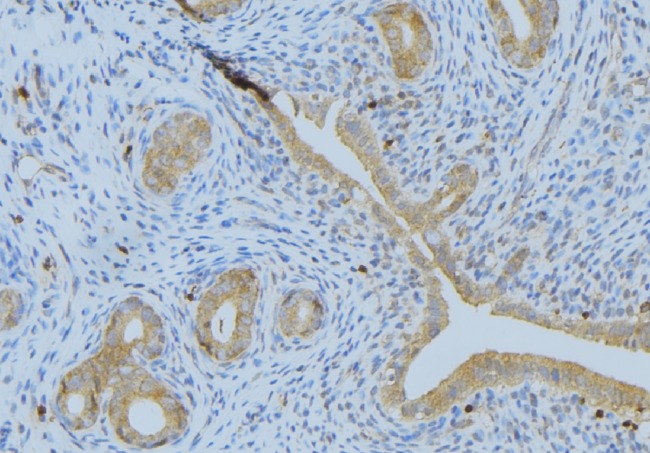 PDGF-AA Antibody - 1:100 staining human uterus tissue by IHC-P. The sample was formaldehyde fixed and a heat mediated antigen retrieval step in citrate buffer was performed. The sample was then blocked and incubated with the antibody for 1.5 hours at 22°C. An HRP conjugated goat anti-rabbit antibody was used as the secondary.