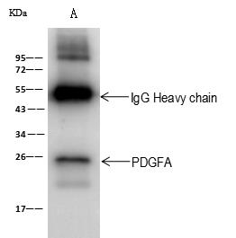 PDGF-AA Antibody - PDGFA was immunoprecipitated using: Lane A: 0.5 mg Jurkat Whole Cell Lysate. 2 uL anti-PDGFA rabbit polyclonal antibody and 60 ug of Immunomagnetic beads Protein A/G. Primary antibody: Anti-PDGFA rabbit polyclonal antibody, at 1:100 dilution. Secondary antibody: Goat Anti-Rabbit IgG (H+L)/HRP at 1/10000 dilution. Developed using the ECL technique. Performed under reducing conditions. Predicted band size: 24 kDa. Observed band size: 24 kDa.