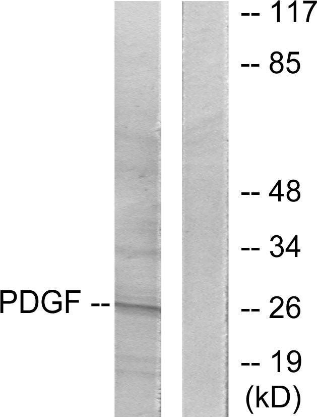 PDGF-BB Antibody - Western blot analysis of lysates from NIH/3T3 cells, using PDGFB Antibody. The lane on the right is blocked with the synthesized peptide.