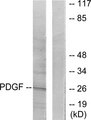 PDGF-BB Antibody - Western blot analysis of lysates from NIH/3T3 cells, using PDGFB Antibody. The lane on the right is blocked with the synthesized peptide.