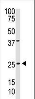 PDGF-BB Antibody - The anti-PDGFB C-term antibody is used in Western blot to detect PDGFB in A375 cell lysate.