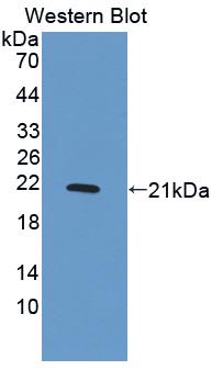 PDGF-BB Antibody - Western blot of PDGF-BB antibody.