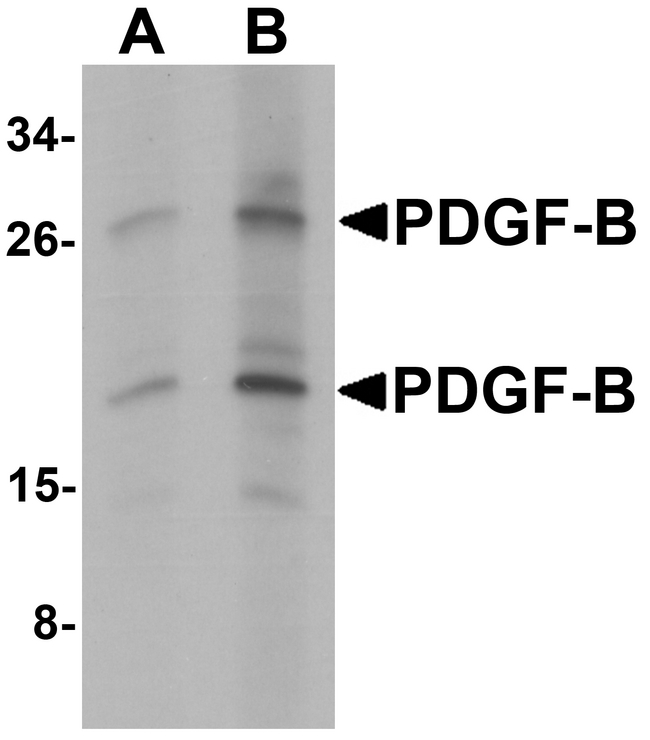 PDGF-BB Antibody - Western blot analysis of PDGF-B in rat liver tissue lysate with PDGF-B antibody at (A) 1 and (B) 2 ug/ml.