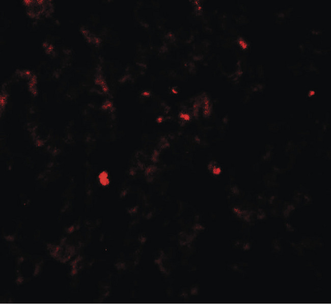 PDGF-BB Antibody - Immunofluorescence of PDGF-B in human liver tissue with PDGF-B antibody at 20 ug/ml.