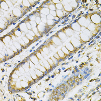 PDGF-BB Antibody - Immunohistochemistry of paraffin-embedded human colon using PDGFB Antibodyat dilution of 1:100 (40x lens).