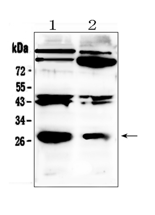 PDGF-BB Antibody - Western blot analysis of PDGF beta using anti-PDGF beta antibody. Electrophoresis was performed on a 5-20% SDS-PAGE gel at 70V (Stacking gel) / 90V (Resolving gel) for 2-3 hours. The sample well of each lane was loaded with 50ug of sample under reducing conditions. Lane 1: rat brain tissue lysates, Lane 2: mouse brain tissue lysates. After Electrophoresis, proteins were transferred to a Nitrocellulose membrane at 150mA for 50-90 minutes. Blocked the membrane with 5% Non-fat Milk/ TBS for 1.5 hour at RT. The membrane was incubated with rabbit anti-PDGF beta antigen affinity purified polyclonal antibody at 0.5 µg/mL overnight at 4°C, then washed with TBS-0.1% Tween 3 times with 5 minutes each and probed with a goat anti-rabbit IgG-HRP secondary antibody at a dilution of 1:10000 for 1.5 hour at RT. The signal is developed using an Enhanced Chemiluminescent detection (ECL) kit with Tanon 5200 system. A specific band was detected for PDGF beta at approximately 27KD. The expected band size for PDGF beta is at 27KD.