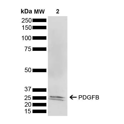 PDGF-BB Antibody - Western blot analysis of Mouse Brain showing detection of 27.3 kDa PDGFB protein using Rabbit Anti-PDGFB Polyclonal Antibody. Lane 1: Molecular Weight Ladder (MW). Lane 2: Mouse Brain. Load: 15 µg. Block: 5% Skim Milk powder in TBST. Primary Antibody: Rabbit Anti-PDGFB Polyclonal Antibody  at 1:1000 for 2 hours at RT with shaking. Secondary Antibody: Goat Anti-Rabbit IgG: HRP at 1:3000 for 1 hour at RT. Color Development: ECL solution for 5 min at RT. Predicted/Observed Size: 27.3 kDa. Other Band(s): 25 kDa.