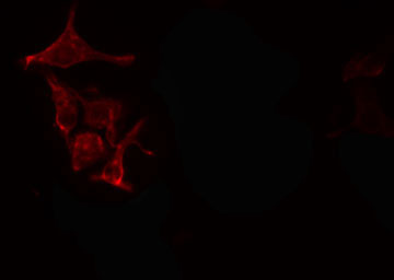 PDGF-BB Antibody - Staining NIH-3T3 cells by IF/ICC. The samples were fixed with PFA and permeabilized in 0.1% Triton X-100, then blocked in 10% serum for 45 min at 25°C. The primary antibody was diluted at 1:200 and incubated with the sample for 1 hour at 37°C. An Alexa Fluor 594 conjugated goat anti-rabbit IgG (H+L) antibody, diluted at 1/600, was used as secondary antibody.
