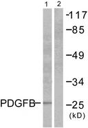PDGF-BB Antibody - Western blot analysis of extracts from NIH/3T3 cells, using PDGFB antibody.
