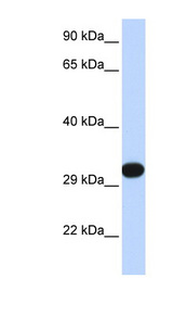 PDGF-BB Antibody - PDGFB antibody Western blot of 293T cell lysate. This image was taken for the unconjugated form of this product. Other forms have not been tested.
