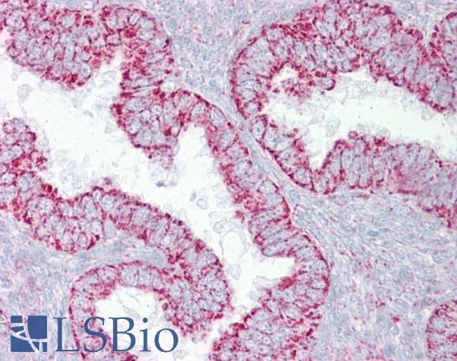 PDGF-BB Antibody - Anti-PDGFB antibody IHC of human uterus. Immunohistochemistry of formalin-fixed, paraffin-embedded tissue after heat-induced antigen retrieval. Antibody concentration 5 ug/ml.  This image was taken for the unconjugated form of this product. Other forms have not been tested.