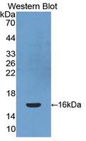PDGF-CC Antibody - Western blot of PDGF-CC antibody.