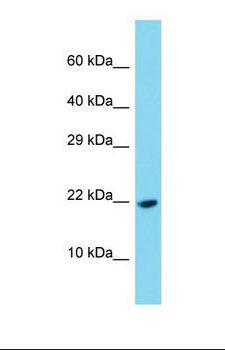 PDGF-CC Antibody - Western blot of Human Fetal Liver. PDGFC antibody dilution 1.0 ug/ml.  This image was taken for the unconjugated form of this product. Other forms have not been tested.