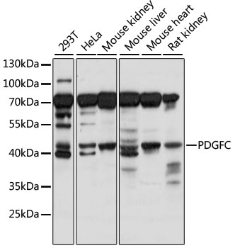 PDGF-CC Antibody - Western blot analysis of extracts of various cell lines, using PDGFC antibody at 1:1000 dilution. The secondary antibody used was an HRP Goat Anti-Rabbit IgG (H+L) at 1:10000 dilution. Lysates were loaded 25ug per lane and 3% nonfat dry milk in TBST was used for blocking. An ECL Kit was used for detection and the exposure time was 5s.
