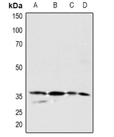 PDGF-CC Antibody - Western blot analysis of PDGFC expression in A549 (A), U87MG (B), mouse kidney (C), mouse muscle (D) whole cell lysates.