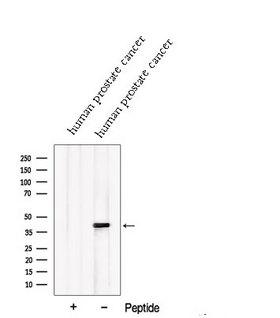 PDGF-D Antibody - Western blot analysis of extracts of human prostate carcinoma tissue using PDGFD antibody. The lane on the left was treated with blocking peptide.