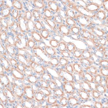 PDGF-D Antibody - Immunohistochemistry of paraffin-embedded Mouse kidney using PDGFD Polyclonal Antibody at dilution of 1:100 (40x lens).