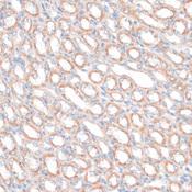 PDGF-D Antibody - Immunohistochemistry of paraffin-embedded Mouse kidney using PDGFD Polyclonal Antibody at dilution of 1:100 (40x lens).