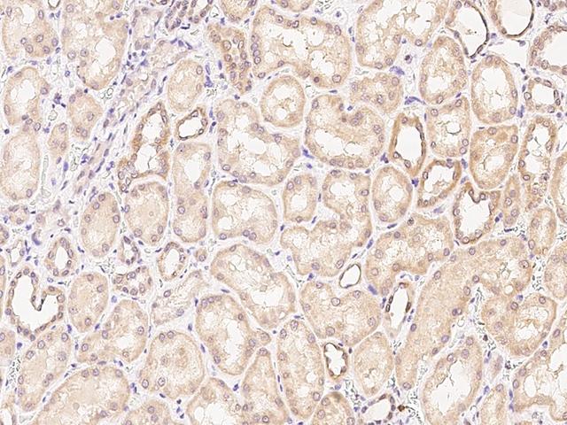 PDGF-D Antibody - Immunochemical staining PDGFD in mouse kidney with rabbit polyclonal antibody at 1:500 dilution, formalin-fixed paraffin embedded sections.