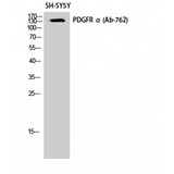 PDGFRA / PDGFR Alpha Antibody - Western blot of PDGFR-alpha antibody