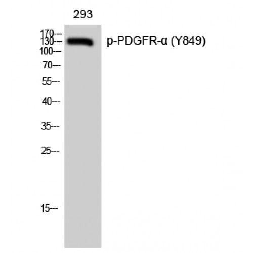 PDGFRA / PDGFR Alpha Antibody - Western blot of Phospho-PDGFR-alpha (Y849) antibody
