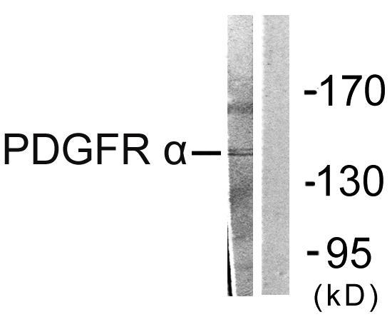 PDGFRA / PDGFR Alpha Antibody - Western blot analysis of lysates from HepG2 cells, using PDGFR alpha Antibody. The lane on the right is blocked with the synthesized peptide.
