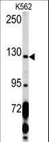 PDGFRA / PDGFR Alpha Antibody - Western blot of PDGFRA Antibody (C-term E1063) in K562 cell line lysates (35 ug/lane). PDGFRA (arrow) was detected using the purified antibody.