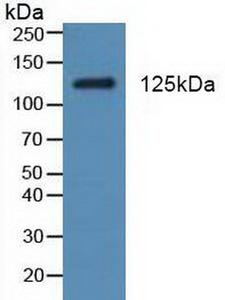 PDGFRA / PDGFR Alpha Antibody - Western Blot; Sample: Rat Testis Tissue.