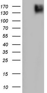 PDGFRA / PDGFR Alpha Antibody - HEK293T cells were transfected with the pCMV6-ENTRY control (Left lane) or pCMV6-ENTRY PDGFRA (Right lane) cDNA for 48 hrs and lysed. Equivalent amounts of cell lysates (5 ug per lane) were separated by SDS-PAGE and immunoblotted with anti-PDGFRA.