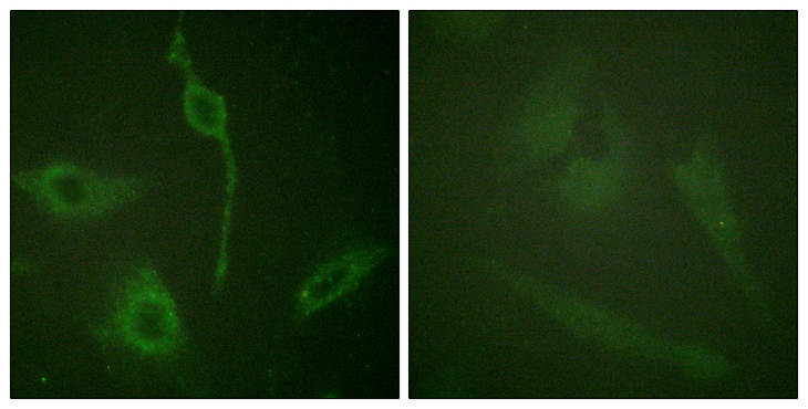 PDGFRA / PDGFR Alpha Antibody - Immunofluorescence analysis of HeLa cells, using PDGFR alpha Antibody. The picture on the right is blocked with the synthesized peptide.