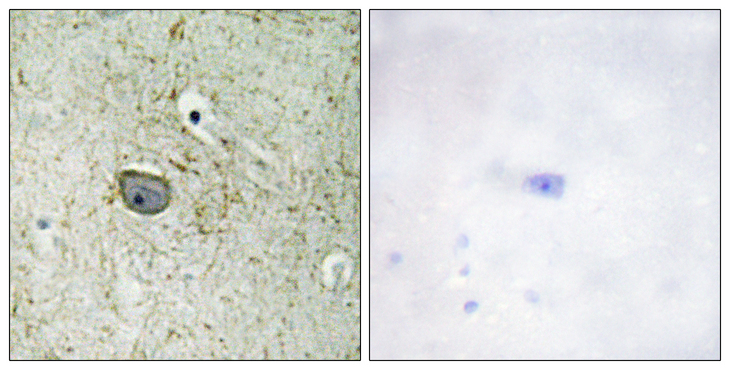 PDGFRA / PDGFR Alpha Antibody - Immunohistochemistry analysis of paraffin-embedded human brain tissue, using PDGFR alpha Antibody. The picture on the right is blocked with the synthesized peptide.