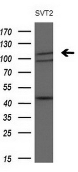 PDGFRA / PDGFR Alpha Antibody - Western blot analysis of extracts. (10ug) from 1 cell line and by using anti-PDGFRA monoclonal antibody at 1:200 dilution.