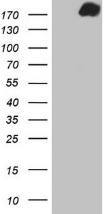 PDGFRA / PDGFR Alpha Antibody - HEK293T cells were transfected with the pCMV6-ENTRY control (Left lane) or pCMV6-ENTRY PDGFRA (Right lane) cDNA for 48 hrs and lysed. Equivalent amounts of cell lysates (5 ug per lane) were separated by SDS-PAGE and immunoblotted with anti-PDGFRA.