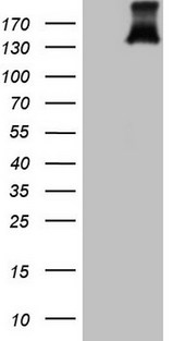 PDGFRA / PDGFR Alpha Antibody - HEK293T cells were transfected with the pCMV6-ENTRY control (Left lane) or pCMV6-ENTRY PDGFRA (Right lane) cDNA for 48 hrs and lysed. Equivalent amounts of cell lysates (5 ug per lane) were separated by SDS-PAGE and immunoblotted with anti-PDGFRA (1:2000).