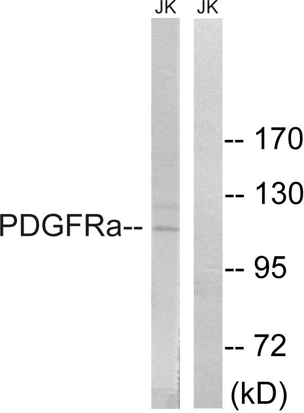 PDGFRA / PDGFR Alpha Antibody - Western blot analysis of lysates from Jurkat cells, using PDGFRa Antibody. The lane on the right is blocked with the synthesized peptide.
