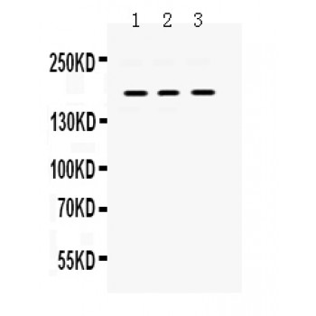 PDGFRA / PDGFR Alpha Antibody - PDGFRA antibody Western blot. All lanes: Anti PDGFRA at 0.5 ug/ml. Lane 1: Rat Brain Tissue Lysate at 50 ug. Lane 2: HELA Whole Cell Lysate at 40 ug. Lane 3: NIH3T3 Whole Cell Lysate at 40 ug. Predicted band size: 180 kD. Observed band size: 180 kD.