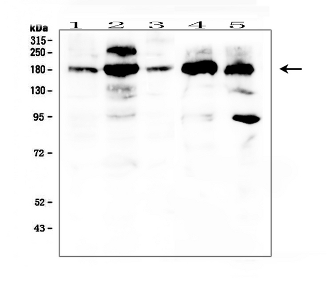 PDGFRA / PDGFR Alpha Antibody - Western blot analysis of PDGFRA using anti-PDGFRA antibody. Electrophoresis was performed on a 5-20% SDS-PAGE gel at 70V (Stacking gel) / 90V (Resolving gel) for 2-3 hours. The sample well of each lane was loaded with 50ug of sample under reducing conditions. Lane 1: human HT1080 whole cell lysates, Lane 2: human Caco-2 whole cell lysates, Lane 3: human U20S whole cell lysates, Lane 4: human PC-3 whole cell lysates, Lane 5: human 293T whole cell lysates. After Electrophoresis, proteins were transferred to a Nitrocellulose membrane at 150mA for 50-90 minutes. Blocked the membrane with 5% Non-fat Milk/ TBS for 1.5 hour at RT. The membrane was incubated with rabbit anti-PDGFRA antigen affinity purified polyclonal antibody at 0.5 µg/mL overnight at 4°C, then washed with TBS-0.1% Tween 3 times with 5 minutes each and probed with a goat anti-rabbit IgG-HRP secondary antibody at a dilution of 1:10000 for 1.5 hour at RT. The signal is developed using an Enhanced Chemiluminescent detection (ECL) kit with Tanon 5200 system. A specific band was detected for PDGFRA at approximately 123KD. The expected band size for PDGFRA is at 180KD.