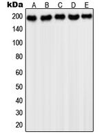 PDGFRA / PDGFR Alpha Antibody - Western blot analysis of PDGFR alpha expression in HepG2 (A); NIH3T3 (B); Saos2 (C); HeLa (D); A431 (E) whole cell lysates.