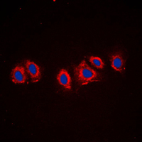 PDGFRA / PDGFR Alpha Antibody - Immunofluorescent analysis of PDGFR alpha staining in NIH3T3 cells. Formalin-fixed cells were permeabilized with 0.1% Triton X-100 in TBS for 5-10 minutes and blocked with 3% BSA-PBS for 30 minutes at room temperature. Cells were probed with the primary antibody in 3% BSA-PBS and incubated overnight at 4 C in a humidified chamber. Cells were washed with PBST and incubated with a DyLight 594-conjugated secondary antibody (red) in PBS at room temperature in the dark. DAPI was used to stain the cell nuclei (blue).