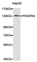 PDGFRA / PDGFR Alpha Antibody - Western blot of extracts of HepG2 cell lines, using PDGFRA antibody.