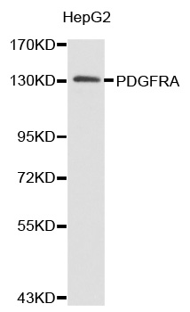 PDGFRA / PDGFR Alpha Antibody - Western blot analysis of extracts of HepG2 cell lines.