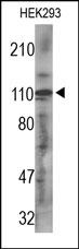 PDGFRA / PDGFR Alpha Antibody - The PDGFRA Antibody is used in Western blot to detect PDGFRA in HEK293 cell lysate.