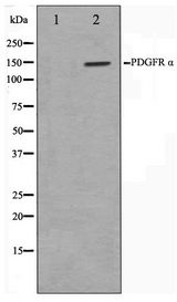 PDGFRA / PDGFR Alpha Antibody - Western blot of 293 cell lysate using PDGFRalpha Antibody