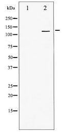 PDGFRA / PDGFR Alpha Antibody - Western blot of PDGFRa expression in Jurkat whole cell lysates,The lane on the left is treated with the antigen-specific peptide.