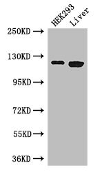 PDGFRA / PDGFR Alpha Antibody - Positive WB detected in:HEK293 whole cell lysate,Mouse liver tissue;All lanes: PDGFRA antibody at 3ug/ml;Secondary;Goat polyclonal to rabbit IgG at 1/50000 dilution;Predicted band size: 123,25,83 kDa;Observed band size: 123 kDa;
