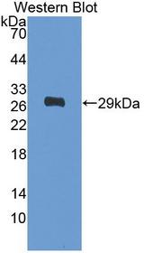 PDGFRA / PDGFR Alpha Antibody - Western Blot; Sample: Recombinant PDGFRa, Human.