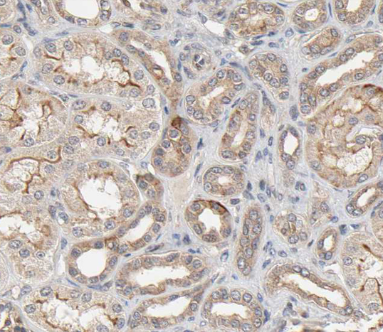 PDGFRA / PDGFR Alpha Antibody - 1:100 staining human kidney tissue by IHC-P. The tissue was formaldehyde fixed and a heat mediated antigen retrieval step in citrate buffer was performed. The tissue was then blocked and incubated with the antibody for 1.5 hours at 22°C. An HRP conjugated goat anti-rabbit antibody was used as the secondary.